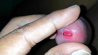 Sri Lankan insertion