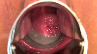 Amateur Asian Japanese Anal Creampie