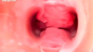 Endoscope